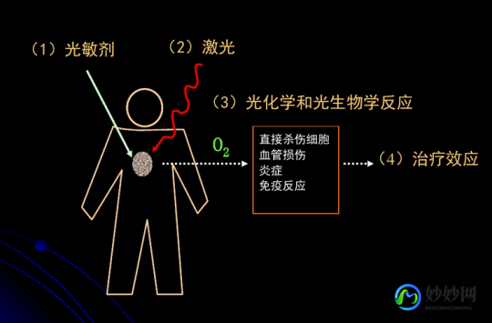 pdt光动力疗法,光动力的原理介绍