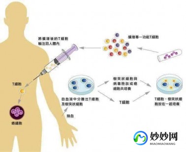 t型淋巴瘤,淋巴瘤t型是什么意思