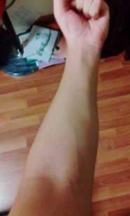 下面被又粗又长玩肿,为什么女生做完之后下面会肿