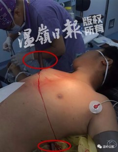 下面被又粗又长玩肿,为什么女生做完之后下面会肿