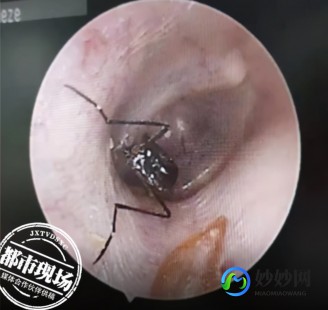 虫子会爬进耳朵吗,耳朵会进虫子吗
