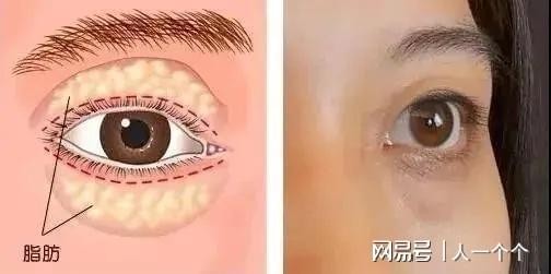 oct检查多少钱,眼部oct