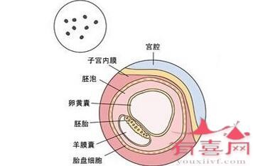 空囊是什么意思,空孕囊是什么原因造成的