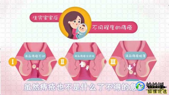 产后得了痔疮怎么办,顺产有痔疮怎么好得快