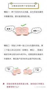 双胎能顺产吗,双胎能顺产吗