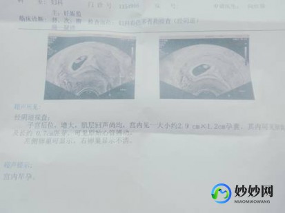 卵黄囊是啥,孕黄囊是什么