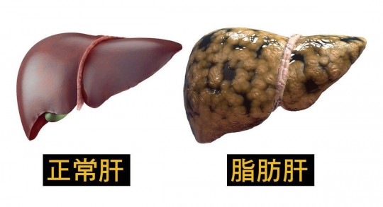 保肝护肝吃什么,保肝护肝吃什么
