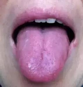 健康,正常的是什么样的