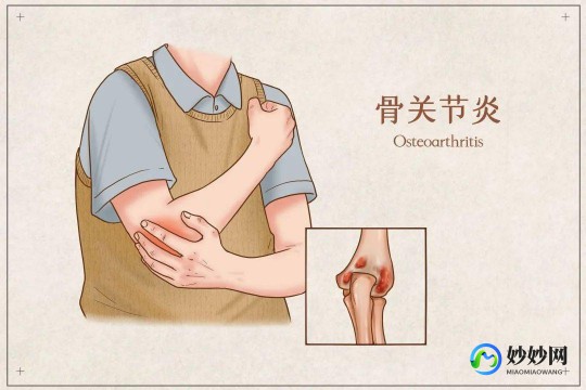 关节酸痛,关节酸痛是怎么回事