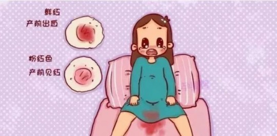临产前见红,临产先见红了怎么办
