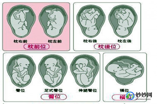 rsp是什么意思,胎位RSP是什么位置？了解这个对宝宝发育很重要