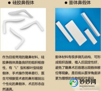 硅胶假体隆鼻材料,假体隆鼻用什么材料