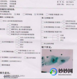 tct是什么,TCT是什么