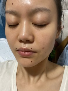 998816,点痣挂什么科
