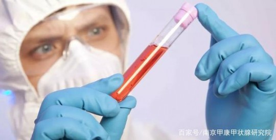 空腹抽血可以喝水吗,空腹抽血能喝水吗