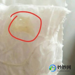 分泌物透明果冻状,白带透明果冻状态