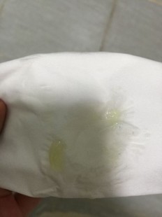 分泌物透明果冻状,白带透明果冻状态