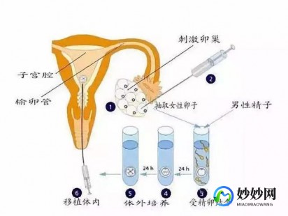 取卵针,试管取卵针为啥要选长度和粗细？影响采卵效果是关键