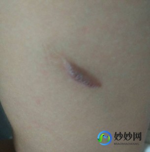 瘙痒,口特别痒