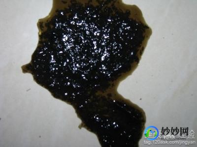 拉肚子拉出血,拉肚子大便出血