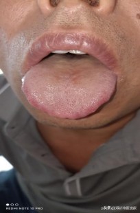 浑身发抖,全身发冷发抖严重震颤