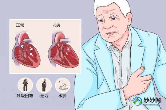慢性心衰,什么叫慢性心衰
