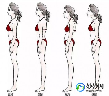 圆肩驼背,圆肩驼背怎么矫正