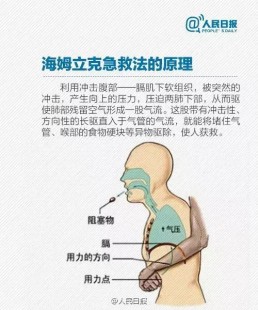 气道异物梗阻,急救科普-气道梗阻