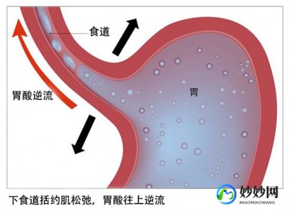 烧心是怎么回事,老烧心是什么原因