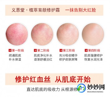 红血丝修护,修复红血丝的方法