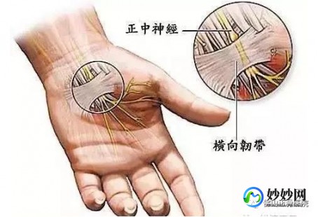5p是什么意思,5p综合征是什么意思