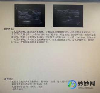 乳腺结节怎么调理能消除,乳腺结节怎么调理才能消失