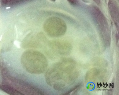 精液由什么组成,精液的成分