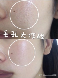 细致毛孔,怎么细致毛孔