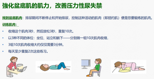 压力性尿失禁,什么是压力性尿失禁
