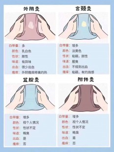 女性外阴瘙痒,女性引起外阴瘙痒的11个原因