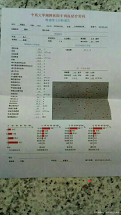 精子活力低,精子活力稍低