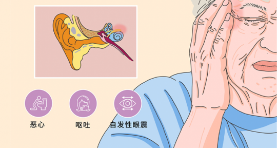 前庭神经元炎,前庭神经元炎严重吗
