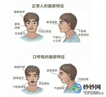 腺样体肥大危害,腺样体肥大有什么影响