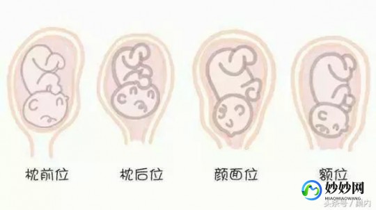胎位lsa,胎位LSA是什么位置