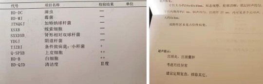 同房后出血是什么原因,做完那个之后为什么会有血