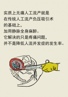 人流痛吗,流产会疼吗