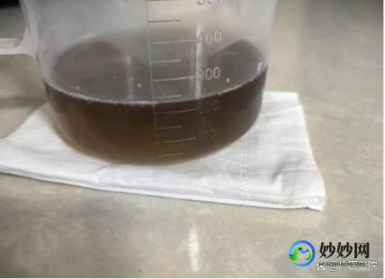 尿褐色,尿液出现茶褐色是怎么回事