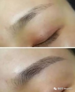 皮肤的颜色,哪些因素与皮肤颜色有关