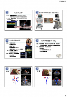 tcd是什么,TCD检查是什么