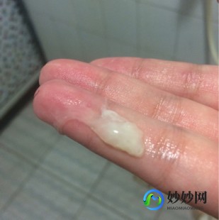 快点我下面水太痒,下面出水样分泌物还有点痒