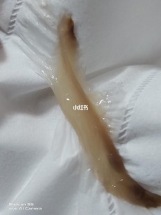 下面老是不自觉流液体,下面莫名流水怎么回事