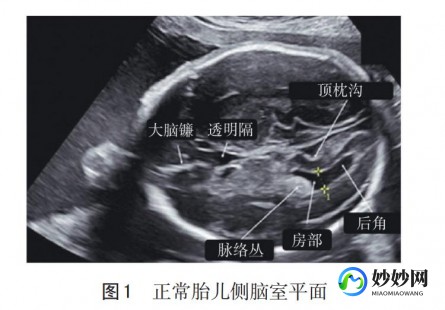四维是哪四维,什么是四维彩超