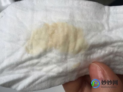 有白带是怎么回事,女性老是流白色的东西