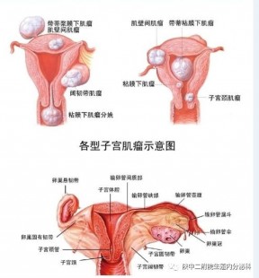 性器官图,女性外生器殖简介图